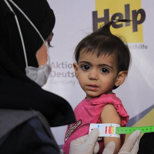 Das syrische Mädchen Amani wird auf Unterernährung untersucht