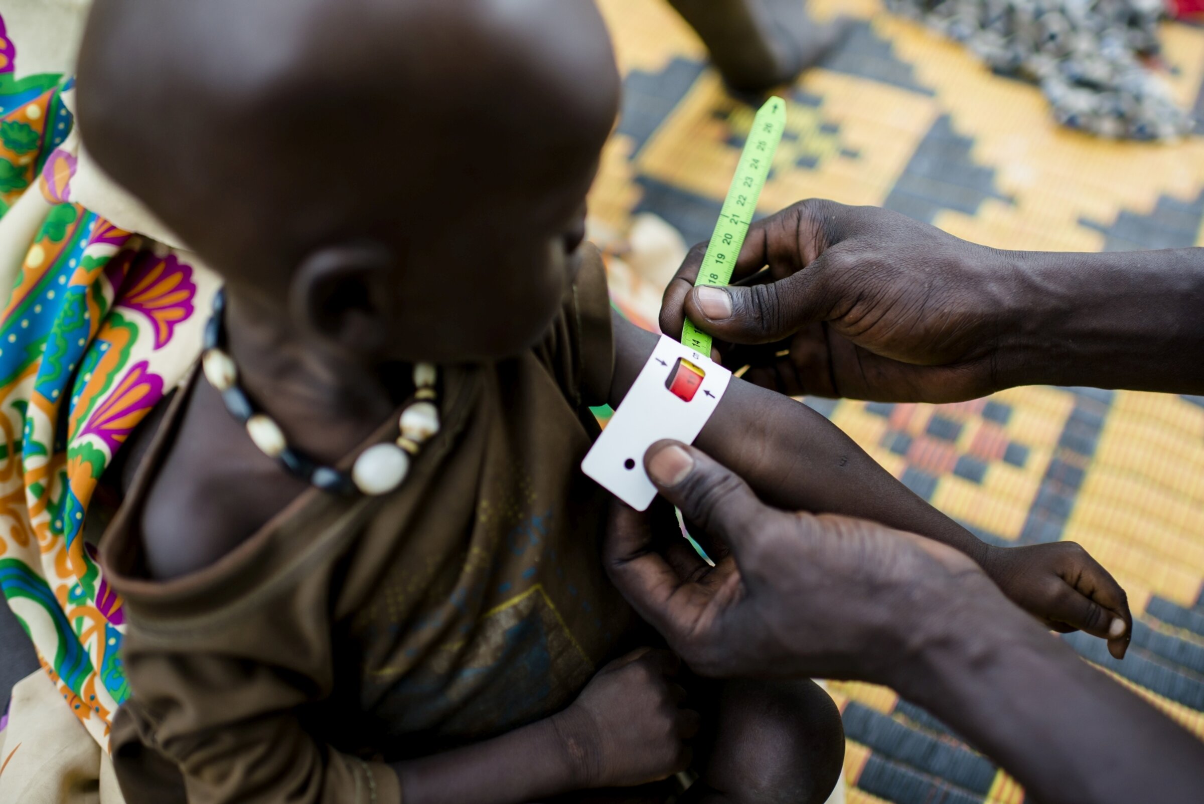 Ein Mitarbeiter von Help misst den Oberarm-Umfang eines Kindes im Südsudan, um den Grad der Unterernährung zu ermitteln.
